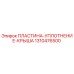 Оригинальная пластина-уплотнение 1310476500 Epiroc