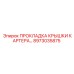 8973035875 ПРОКЛАДКА КРЫШКИ КАРТЕРА Epiroc