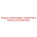 6231645100 ПРОКЛАДКА-НИЖНЯЯ-КАРТЕРА Epiroc