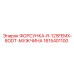 1615401100 ФОРСУНКА-R-125FEMX-8ODT-МУЖЧИНА Epiroc