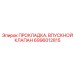 6996012815 ПРОКЛАДКА, ВПУСКНОЙ КЛАПАН Epiroc
