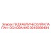9245998494 ГИДРАВЛИЧЕСКИЙ КЛАПАН-ОСНОВАНИЕ Epiroc